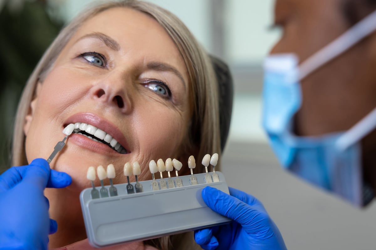 Smile makeover consultation veneers shade selection