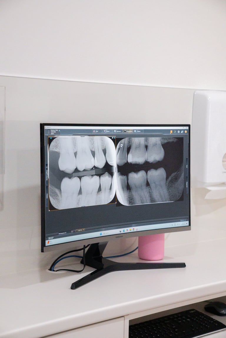 Dental X-ray images displayed on a computer monitor in a dental office setting